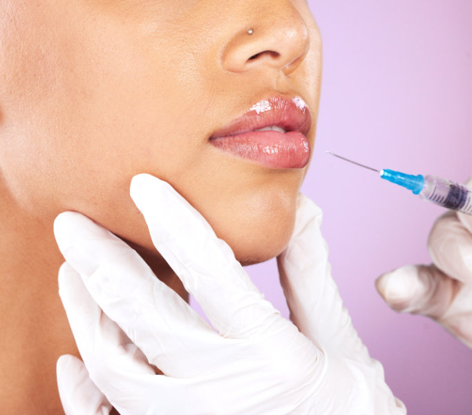 Dermal Fillers